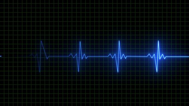 Glowing neon blue color heartbeat and pulse line with grid, seamless and loop motion animate footage.glowing neon heartbeat rate and pulse on black screen, seamless and loop motion animate footage - Powered by Adobe