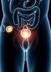 Illustration of the male anatomy highlighting prostate cancer and other organs