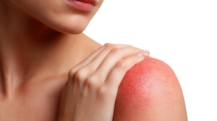 Close-up of a woman's shoulder with irritation, showcasing skin condition on white isolated background.