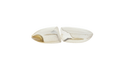 Brain Section Amygdala Hippocampus