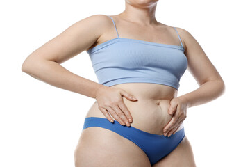 Liposuction. Woman in underwear touching her belly on white background, closeup