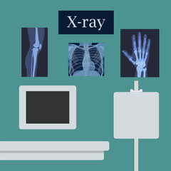 equipment for X-ray examination as well as X-rays of a person's leg, hand, chest on an aquamarine background