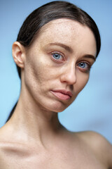 Obraz premium Comparison portrait of a woman's face demonstrating skincare improvement before and after treatment.