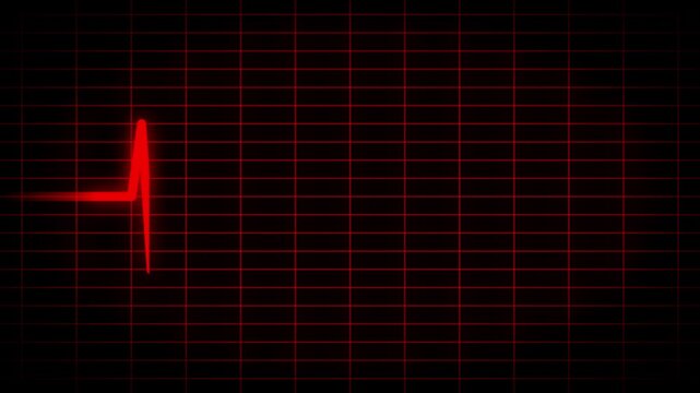 A red electrocardiogram (ECG) tracing showing a single, sharp, downward deflection on a gridded monitor.