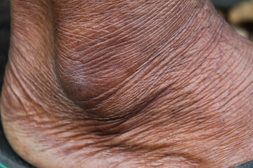 close up of wrinkled skin texture of old man's legs