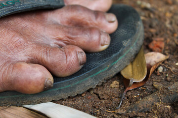close up of old man's toes