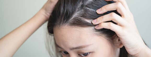 Naklejka premium Young woman worrying about her thin hair and hair fall