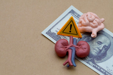 Warning Sign Against Human Organ Trafficking – Global Crime Awareness Concept