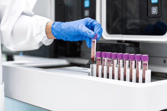 Close up scientist hand wear blue gloves holding blood test tubes with automatic machine in laboratory.Researcher analysis blood chemistry in medical laboratory. Medical healthcare technology research