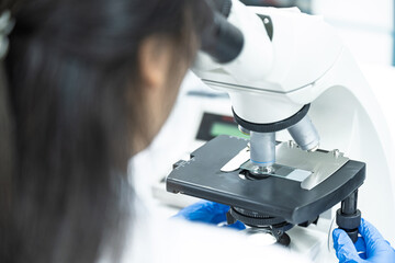 Asian women scientist looking to microscope eyepiece from CBC hematology slide in clinical laboratory.Medical technician analysis blood slide on exam plate microscopic at laboratory department.