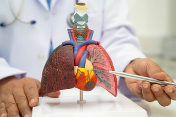 Pneumonia, lung cancer, Asian doctor holding human anatomy model for study diagnosis and treatment...
