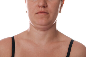 Woman with double chin on white background, closeup