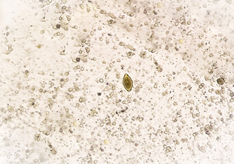 Eggs of Trichuris trichiura (whipworm) in stool, analyze by microscope