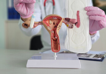A healthcare professional explains the use of feminine hygiene products using a detailed anatomical...