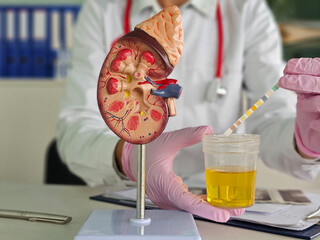 Doctor makes an express urine test using indicator paper in clinic