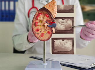 Urology and treatment of kidney diseases. The doctor analyzes the condition of the patient kidneys...