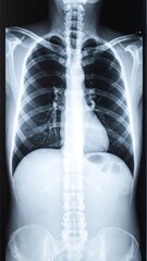 Chest X-ray, showing ribs, spine, and heart