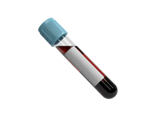 Blood sample in test tube with blue cap
