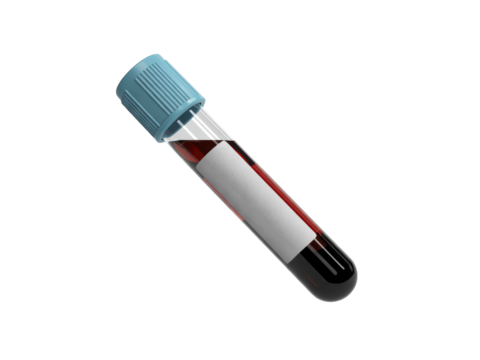 Blood sample in test tube with blue cap
 - Powered by Adobe