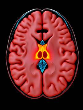 Hypothalamus section highlighting the optic chiasm and mammillary bodies