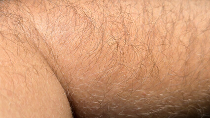 Close-up view of human skin and body hair showcasing texture and detail. The image illustrates the...