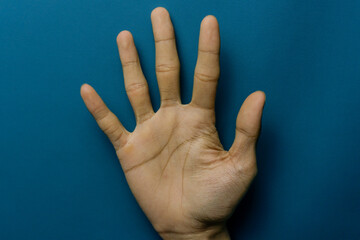 Hand showing the number five against a blue backdrop
