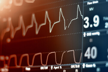 EKG monitor in intra aortic balloon pump machine in icu on blur background, Brain waves in...