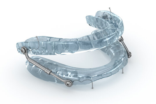 Oral appliance therapy device, sleep apnea treatment.3D illustration