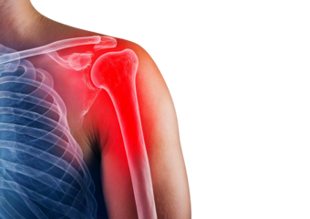 Inflamed shoulder (Turns slightly red). isolated on transparent or white background