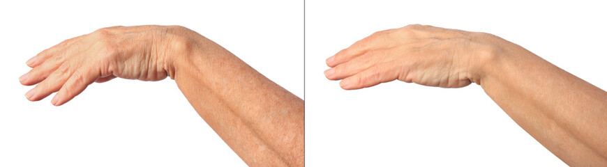 Ageing skin. Woman's hand on white background, closeup. Collage showing difference in texture