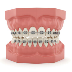dental x ray