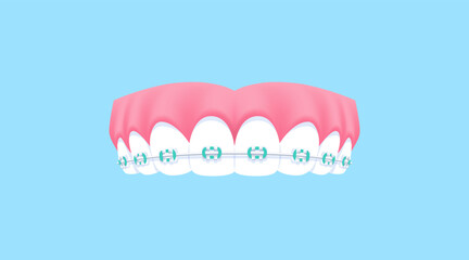 Upper teeth (Orthodontics) illustration vector design. Dental care concept.