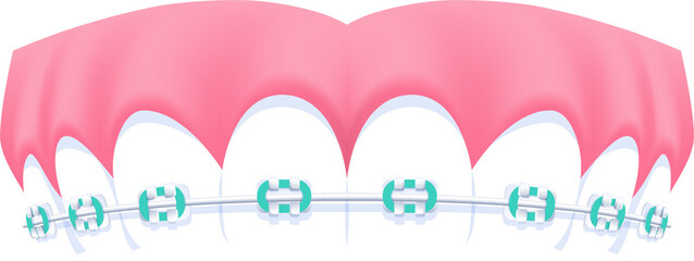 Upper teeth (Orthodontics) illustration design. Dental care concept.