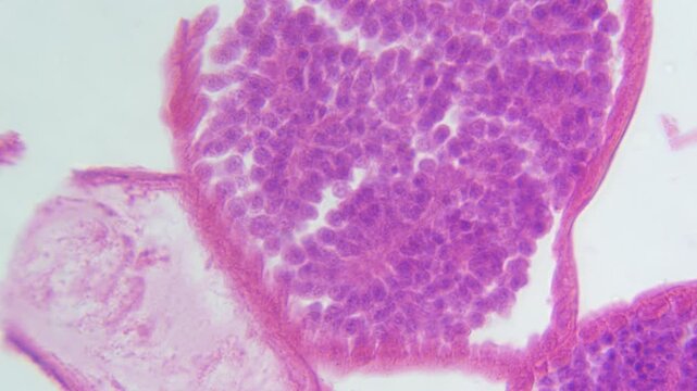 Histology Microscope Video of Ascaris Roundworm Male Testes Cross Section (400x)
