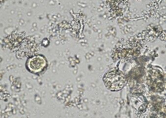 soil microorganisms under a microscope including amoeba, flagellates, nematodes, fungi, bacteria	