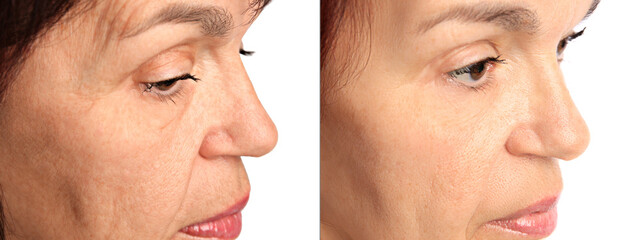 Ageing. Photos of woman's face, closeup. Collage showing difference in skin texture