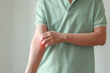 Young asian man itching and scratching on arm from allergic itchy dry skin eczema dermatitis insect...