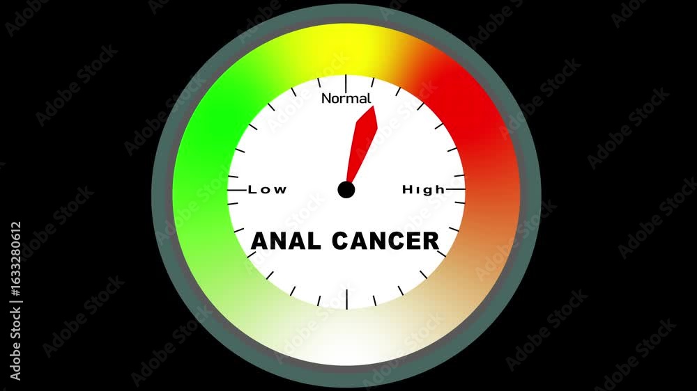 Poster anal cancer text or word displayed with a barometer or tachometer-style gauge showing levels from lo