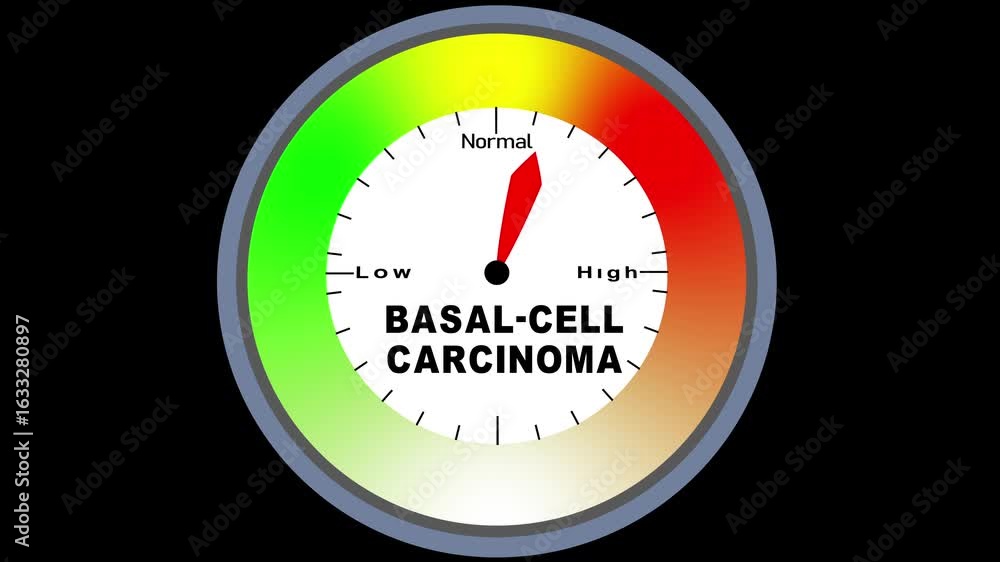 Poster basal-cell carcinoma text or word displayed with a barometer or tachometer-style gauge showing level