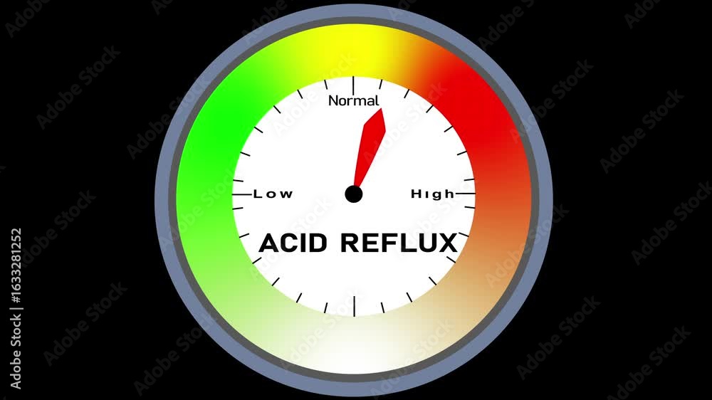 Poster acid reflux text or word with a barometer or tachometer-style gauge showing levels from low to high,