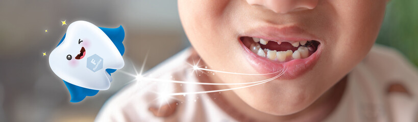 Close-up of a child with missing teeth smiling, with a cute flying tooth cartoon character promoting fluoride protection and children's dental health care.