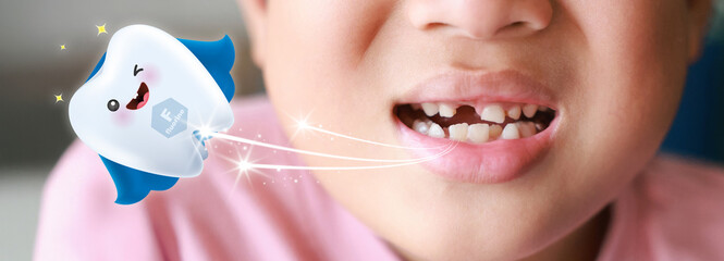Close-up of a child with missing teeth smiling, with a cute flying tooth cartoon character promoting fluoride protection and children's dental health care.