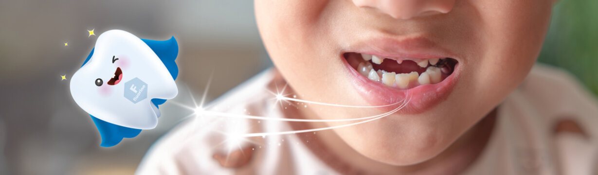 Close-up of a child with missing teeth smiling, with a cute flying tooth cartoon character promoting fluoride protection and children's dental health care.
