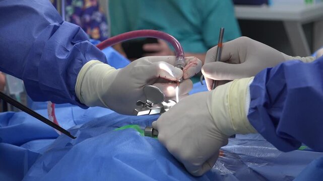 Spine Surgery Explained: Common Procedures, Recovery Expectations, Risks, and Advances in Minimally Invasive Techniques for Treating Chronic Back Pain and Spinal Disorders"