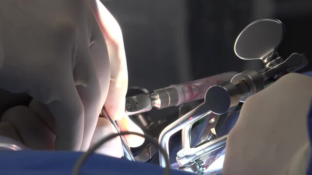 Spine Surgery Explained: Common Procedures, Recovery Expectations, Risks, and Advances in Minimally Invasive Techniques for Treating Chronic Back Pain and Spinal Disorders"