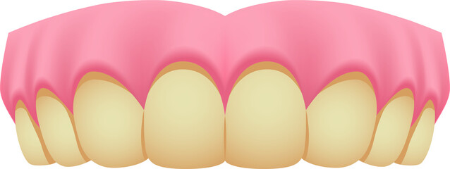 Upper teeth (Yellow) illustration design. Dental care concept.
