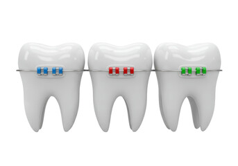 Isolated 3D Render of Teeth with Colorful Braces for Orthodontic Treatment