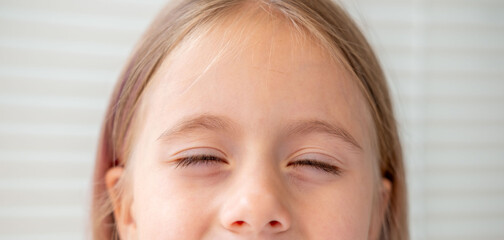 Uncomfortable Little girl squinting eyes, bright light sensitivity, discomfort irritation, dust in...