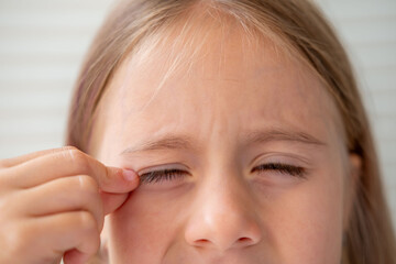 Uncomfortable Little girl squinting eyes, bright light sensitivity, discomfort irritation, dust in...