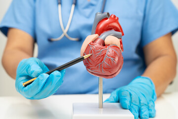 Cardiovascular disease CVD, doctor with heart human model anatomy for treatment patient in hospital.